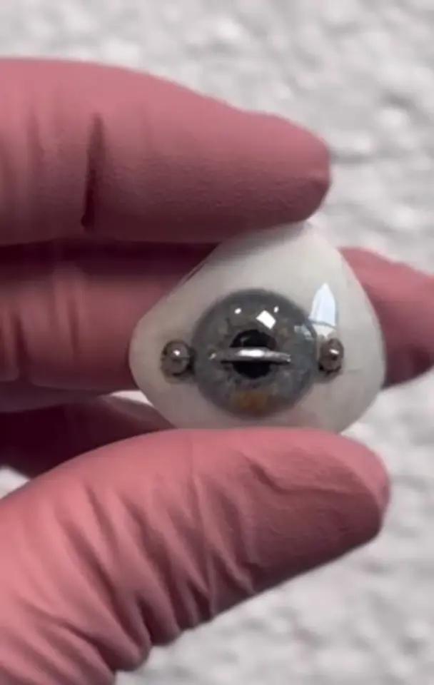 Mulher choca o mundo com piercing no meio do olho e conta a verdade