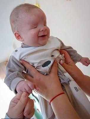 Bebê que nasceu sem olhos é colocado para adoção