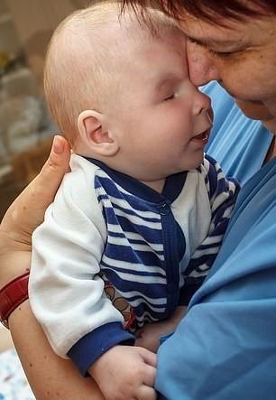 Bebê que nasceu sem olhos é colocado para adoção