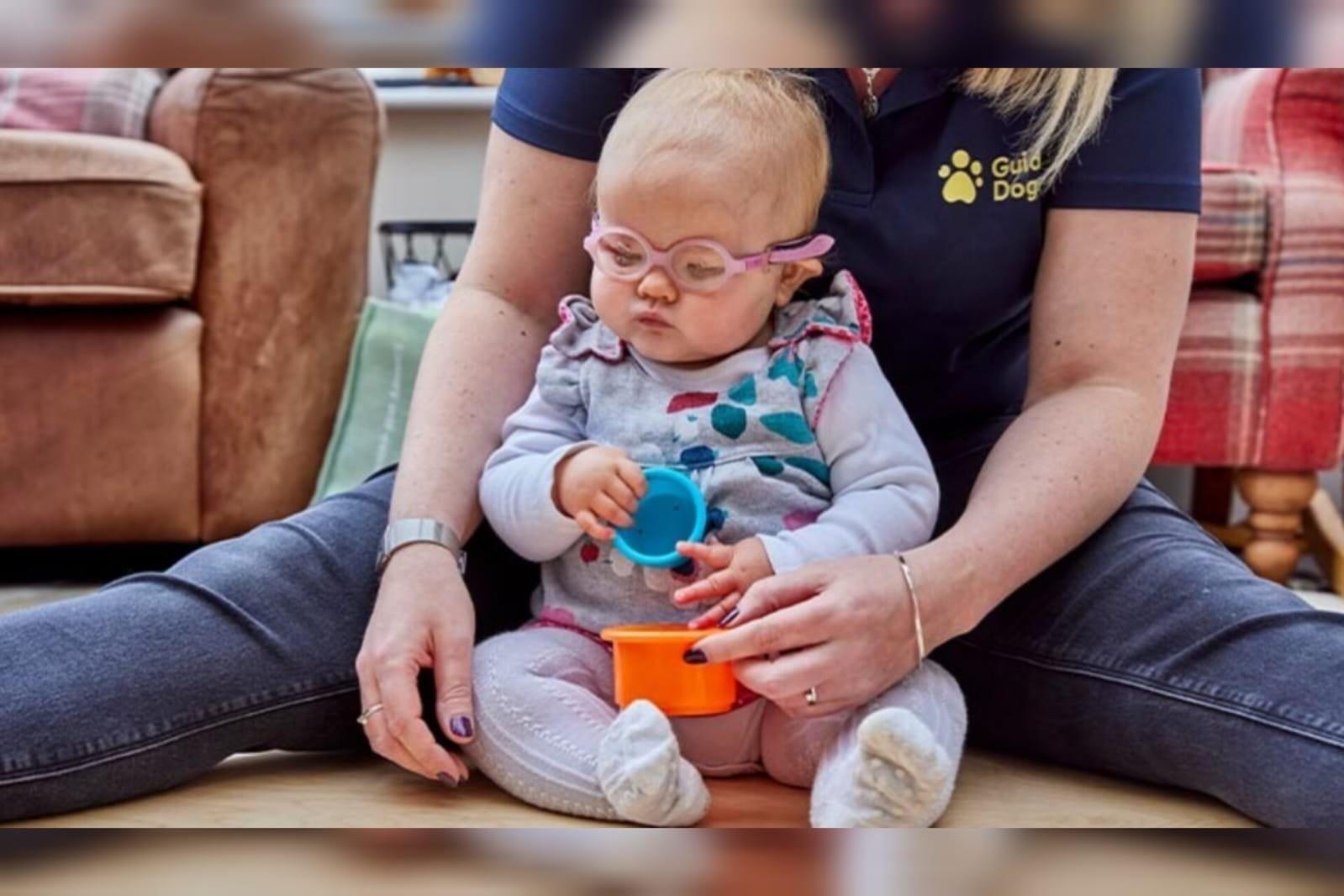 Bebê nasce sem olhos e pais só percebem horas após o parto