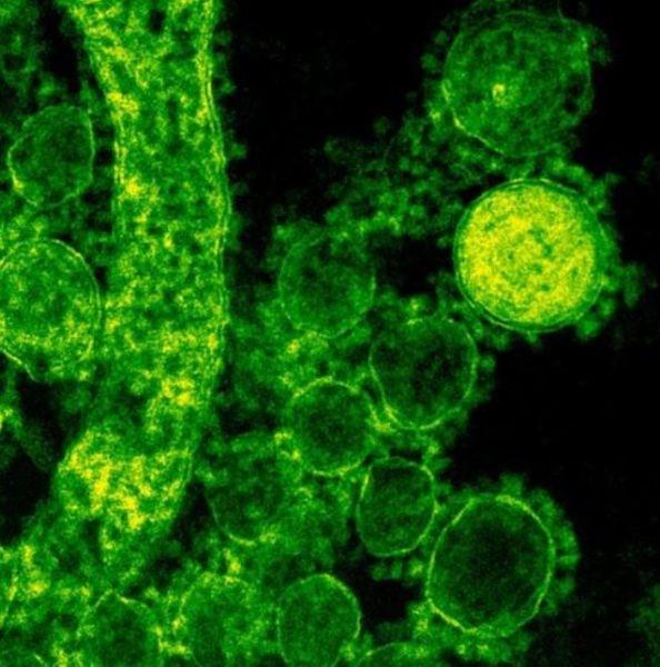 Vírus ‘comedor de ânus’ que mata 30% das pessoas se espalha e gera alerta