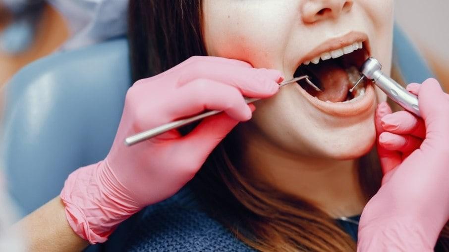 O que é a cárie dental