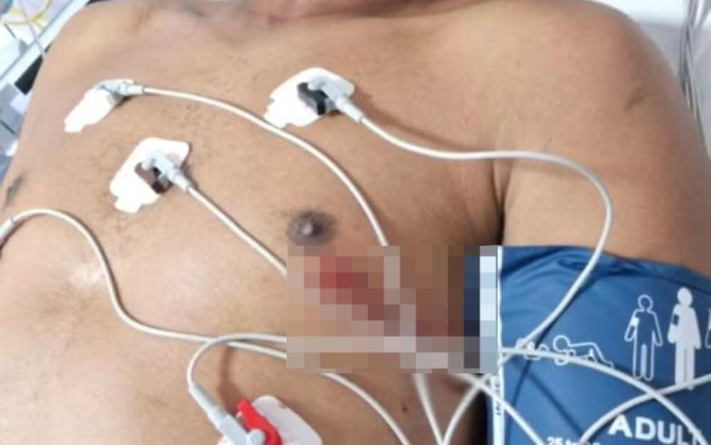 Homem é preso sob suspeita de esfaquear colega que soltou pum dentro de ônibus