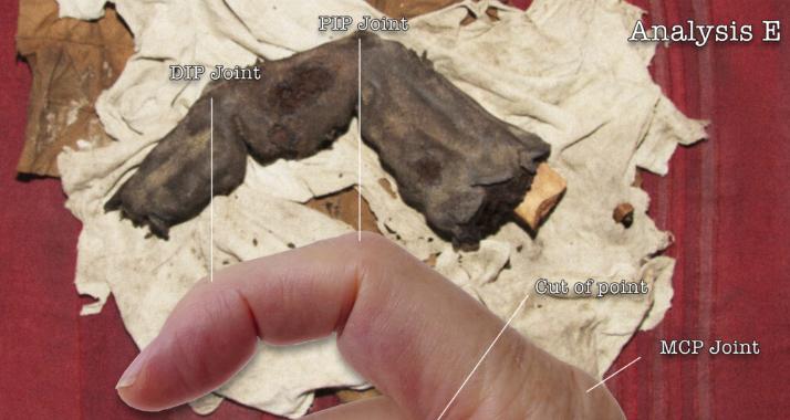 Dedo enorme de 40 cm pode provar existência de ‘gigantes’ no passado