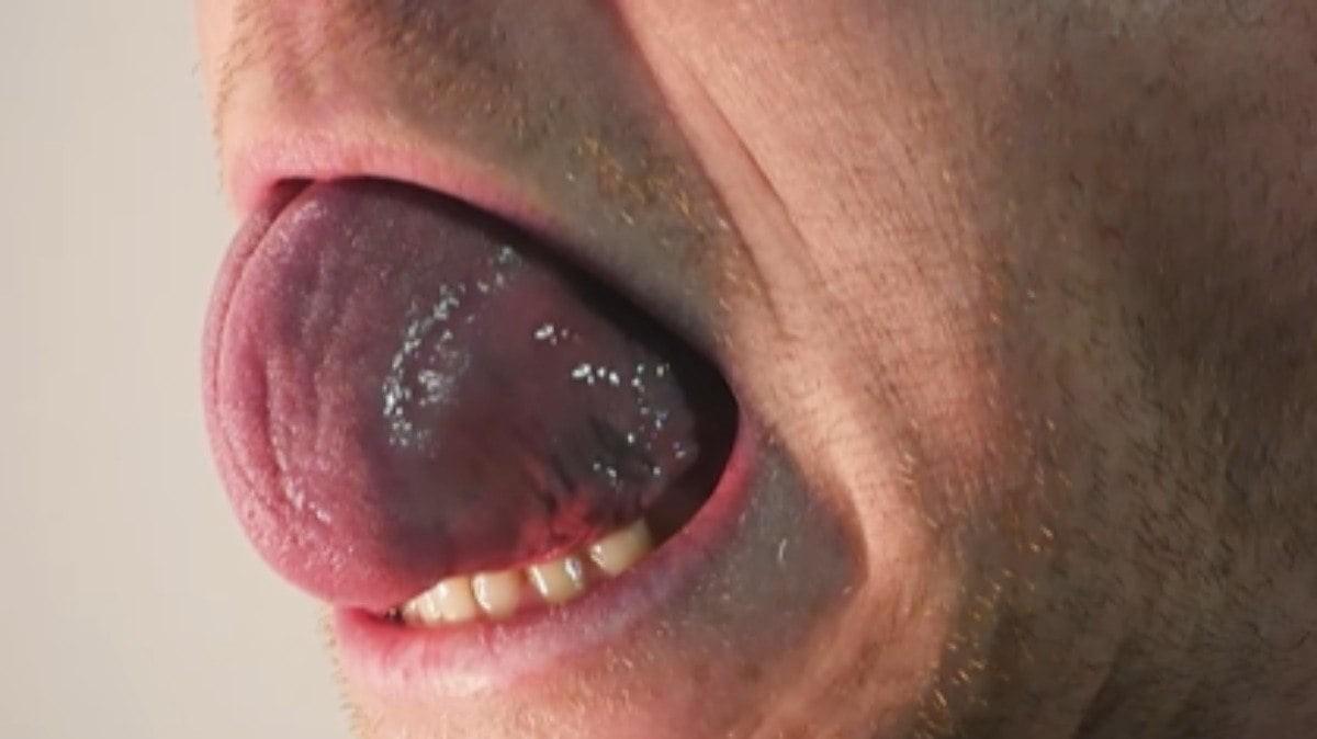 Homem bate recorde de maior língua do mundo
