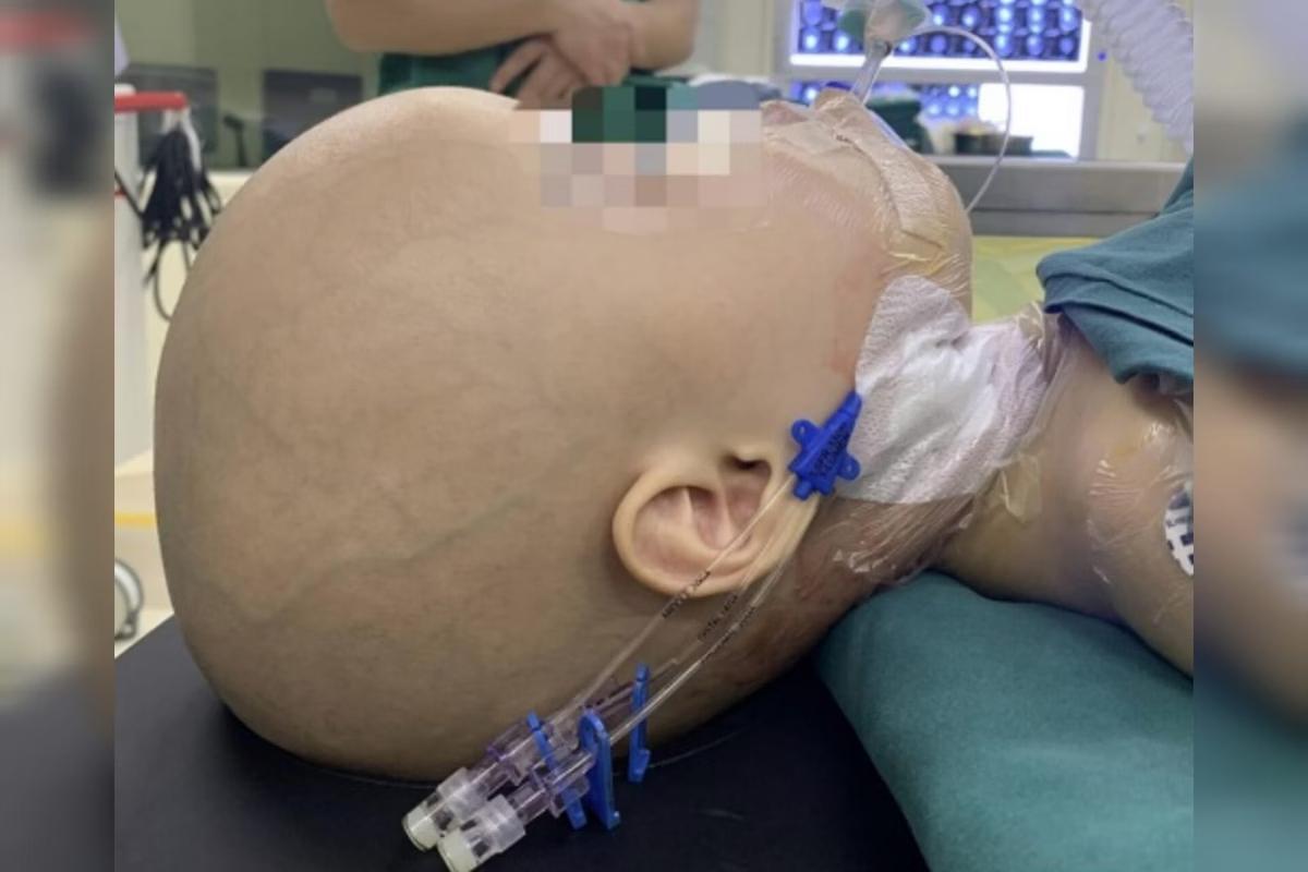 Médicos encontram feto com braços dentro do crânio de bebê de 1 ano