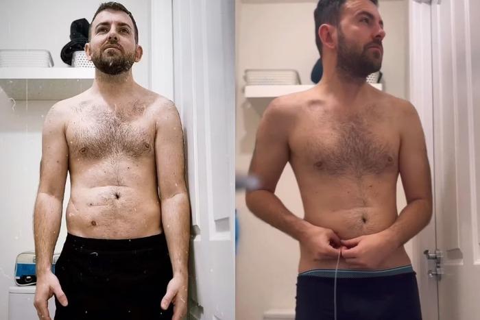 Homem que nasceu sem ânus compartilha rotina nas redes sociais