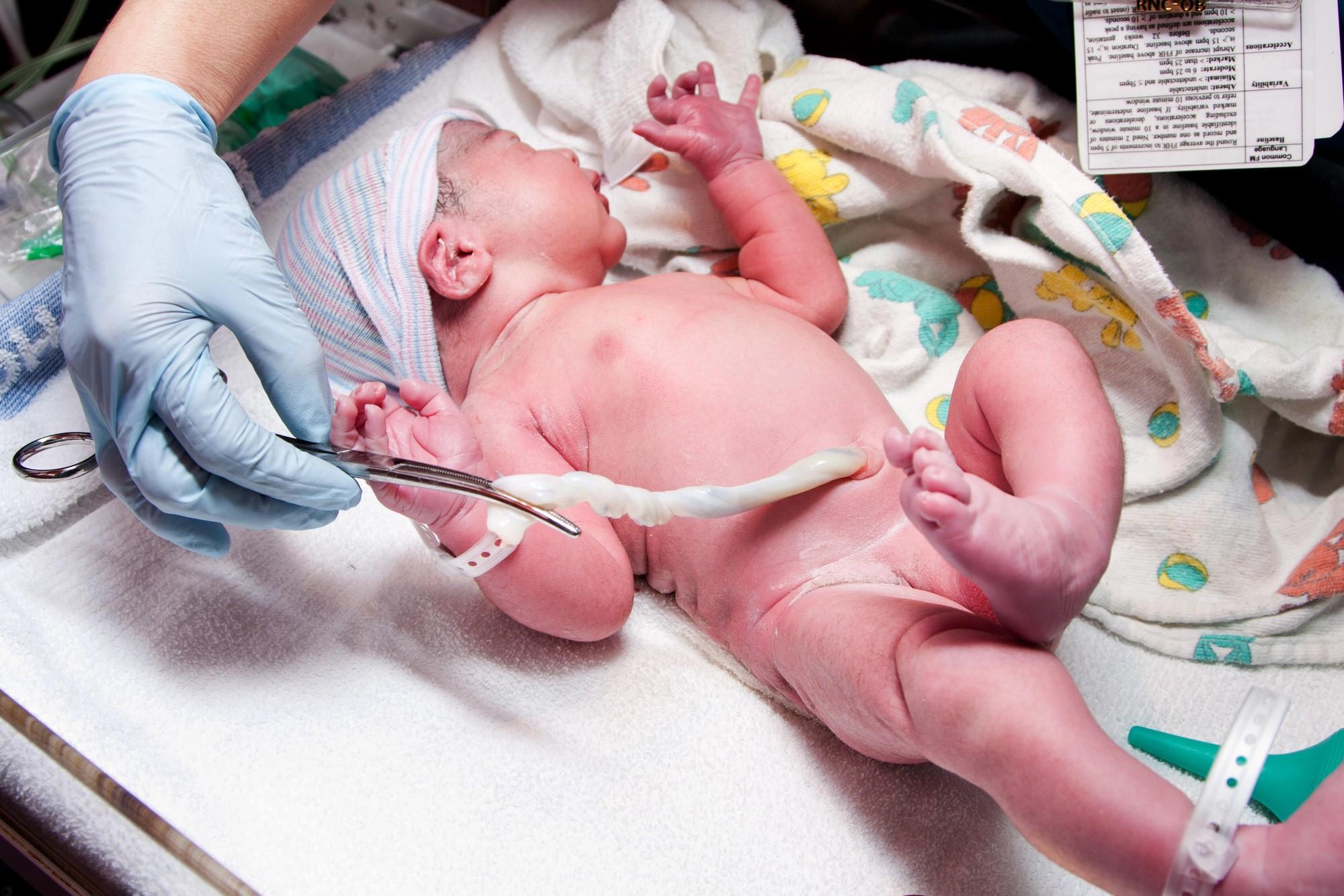 Estudo aponta relação do autismo com cordão umbilical