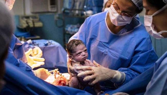 Bebê nasce com carinha de “brava” e foto viraliza nas redes sociais