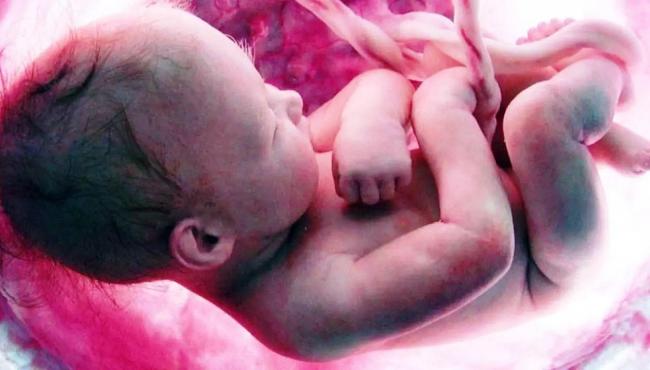 Bebê nasce com feto não desenvolvido do irmão gêmeo no estômago