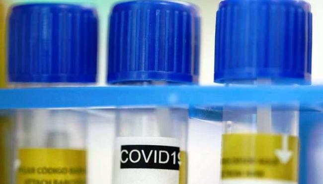Com mais 1 caso, Conceição da Barra passa para 352 infectados por coronavírus