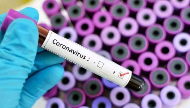 Com mais 6 casos de Covid-19, Conceição da Barra vai a 1.879 infectados