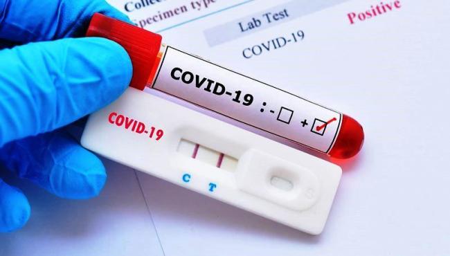 Conceição da Barra registra 1 caso de Covi-19 e total de infectados chega a 1.579