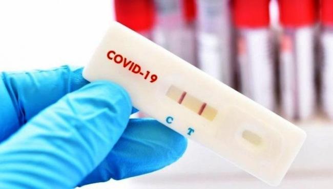 Conceição da Barra registra 12 novos infectados e soma 6.105 casos de Covid-19