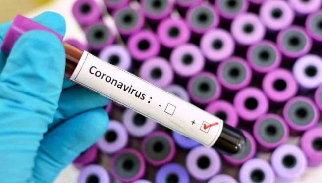 Conceição da Barra registra mais 4 casos da Covid-19 e soma 1.198 infectados