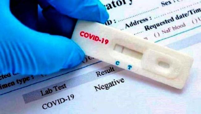 Conceição da Barra tem mais 3 infectados pela Covid-19 e vai a 1.772 casos confirmados