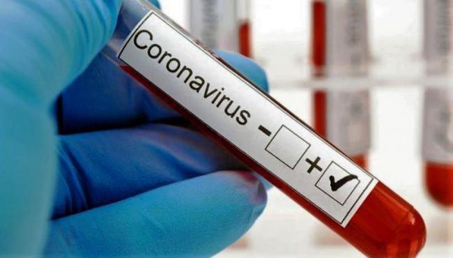 ES registra 1.987 infectados por Covid-19 em 24 horas e casos vai a 466.240 