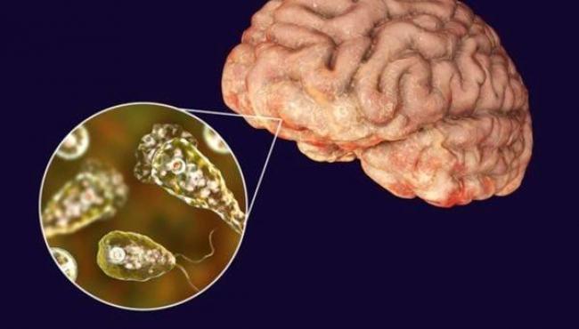 Homem morre após contrair “ameba comedora de cérebro” ao lavar o rosto