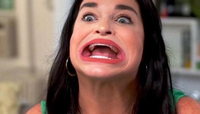 Mulher que viralizou por ter 'maior boca do mundo' entra para livro dos recordes