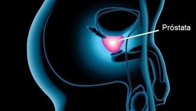 Tratamento para câncer de próstata nem sempre é necessário, diz estudo