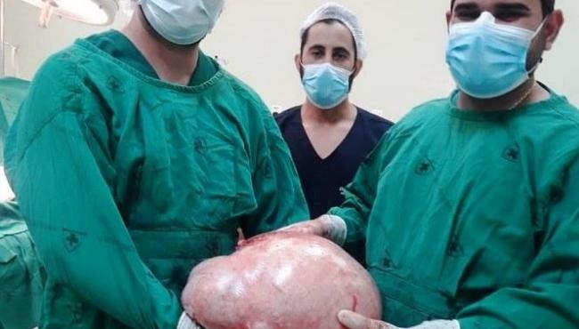 Tumor de quase 20 quilos é retirado do ovário de uma jovem