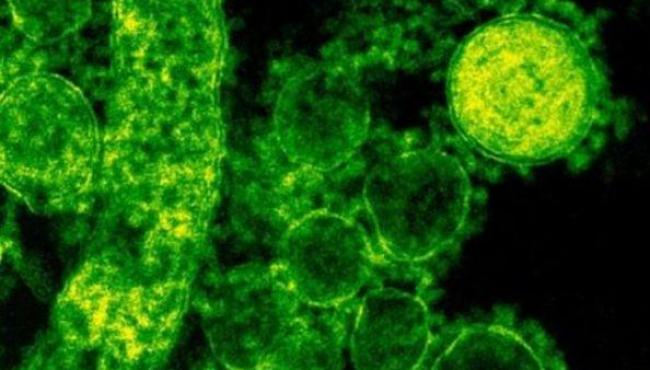 Vírus ‘comedor de ânus’ que mata 30% das pessoas se espalha e gera alerta